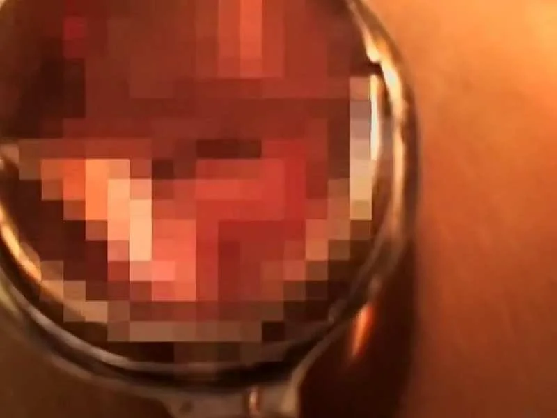 【盗撮動画】婦人科院内盗撮。ギャルKのアソコにクスコを突っ込みピンク色のフレッシュなマン肉丸見えへ